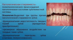 Как вылечить зубы 