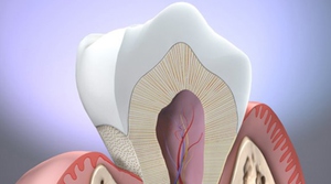 Причины заболевания эрозии  эмали зубов