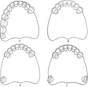 Методика восстановления зубного ряда
