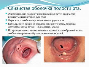 Заболевания полости рта у детей