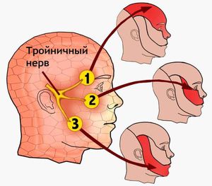 Симптомы и лечение неврита тройничного нерва