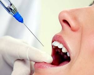 Особенности применения Лидокаина в стоматологии
