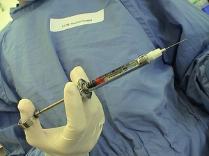 Как проводится анестезия в стоматологии