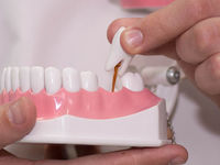Варианты замены зубов