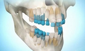 Основные методы регенерации зубов