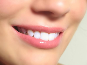 После отбеливания постарайтесь устранить факторы, которые привели к потемнению зубов