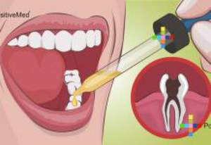 Как от зубной боли избавиться