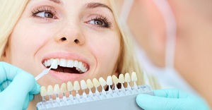 Выполнение эстетической реставрации зубов с применением виниров