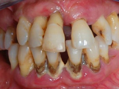 Болезни зубов названия и фото