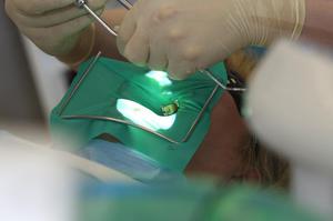 Как лечат зубы с использованием микроскопа