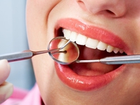 Гнойная гранулема зуба-лечение