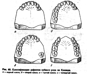 Классификация зубных рядов