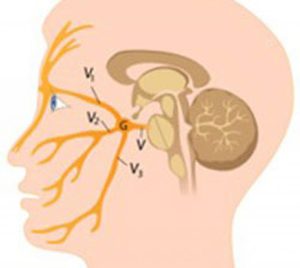 Как протекает воспаление тройничного нерва