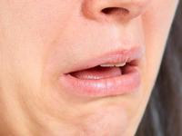 Как избавиться от привкуса во рту