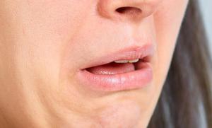 Как избавиться от привкуса во рту
