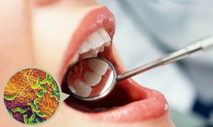 Описание патологии неприятного запаха в полости рта