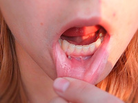 Как вылечить кисту на губе