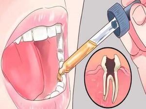 Народные средства при зубной боли