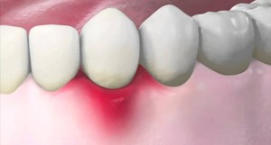 Заболевания зубов и десен