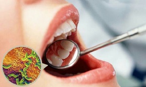 Продукты жизнедеятельности микроорганизмов в полости рта