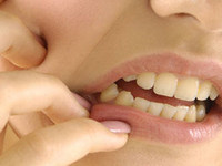 Периостит челюсти: лечение