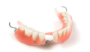 Какие есть варианты протезирования зубов