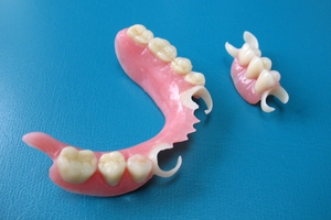 Зубные частичные протезы
