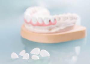 Как делают зубные протезы