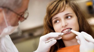 Советы стоматологов по уходу за полостью рта при брекетах