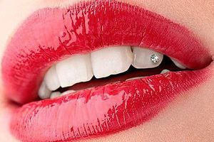 Скайс на зубах: преимущества и недостатки
