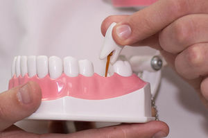 Варианты замены зубов