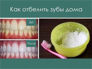 Как отделить зубы