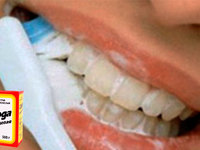 Как можно отбелить зубы содой