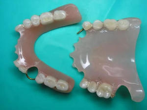 Описание конструкции частично съемных зубных протезов