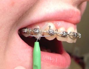 Зубные ершики и щетки
