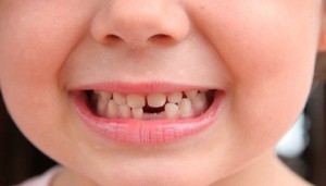 Сколько может быть молочных зубов