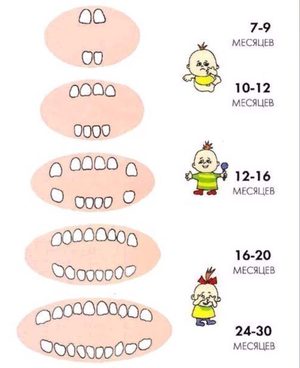 Очередность прорезывания зубов