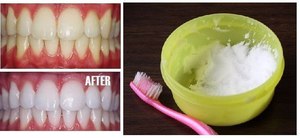 Использование соды для чистки зубов