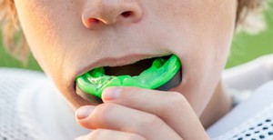 Как защитить зубы при бруксизме