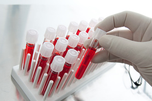 Анализ крови на выявление патологий