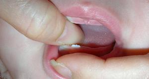 Насморк во время появления зубов