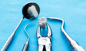 Процедура удаления зуба 