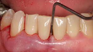 Заболевания зубов