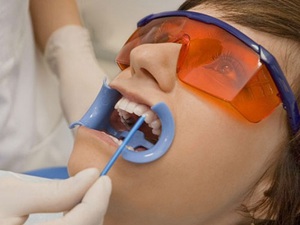 Метод фторирования для восстановления зубной эмали