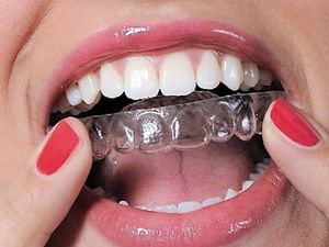  Капы для отбеливания зубной эмали