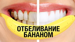 Как отбеливать зубы в домашних условиях