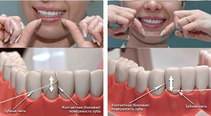 Пользоваться зубной нитью