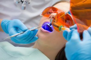 Описание метода отбеливания зубов с помощью ультразвука