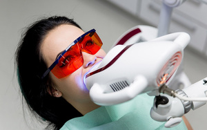 Особенности метода фотоотбеливания зубов