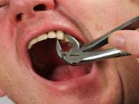 Как без боли вырвать зуб